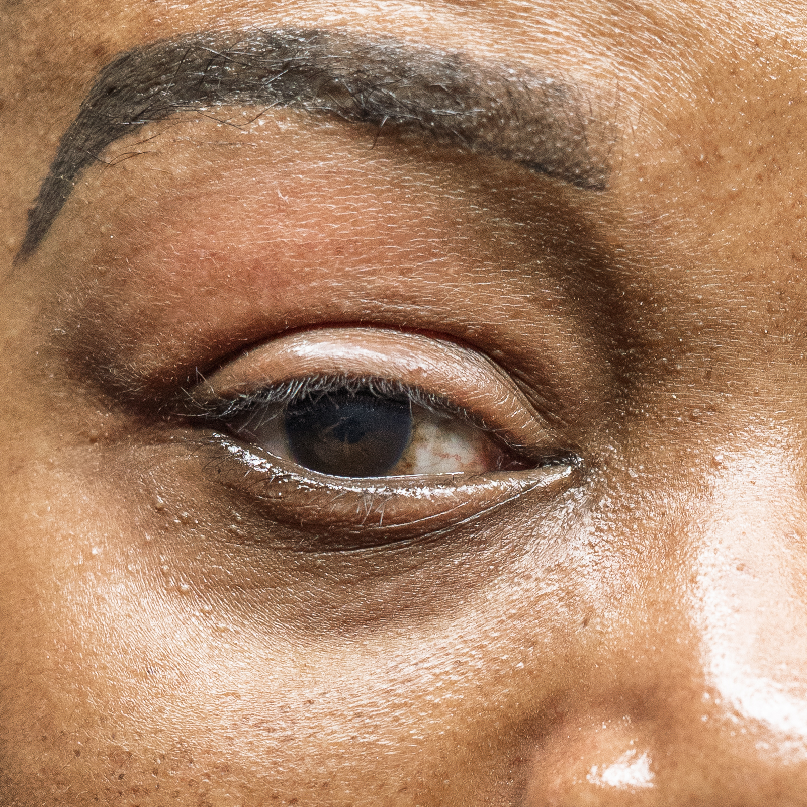 Before image description